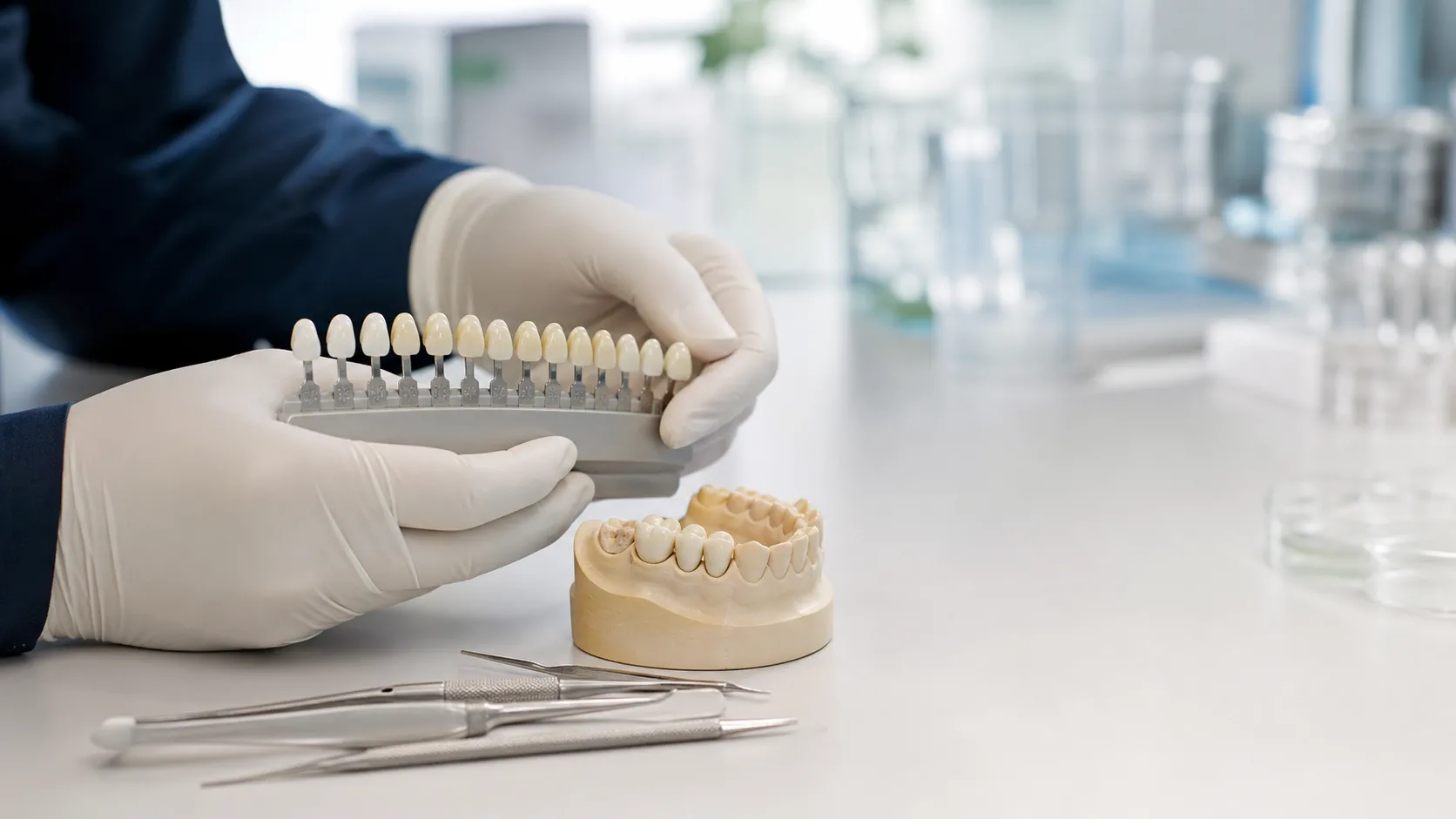 Diş Kronları: Malzemeler, Süreç ve Sorulacak Sorular