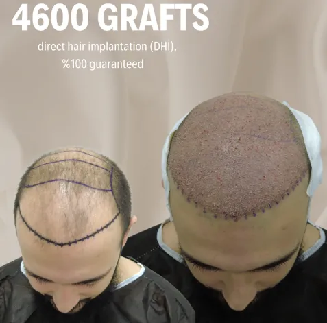 Hairmedica - Klinik / Hastane
